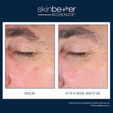 EyeMax AlphaRet Crème de nuit yeux