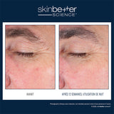 EyeMax AlphaRet Crème de nuit yeux